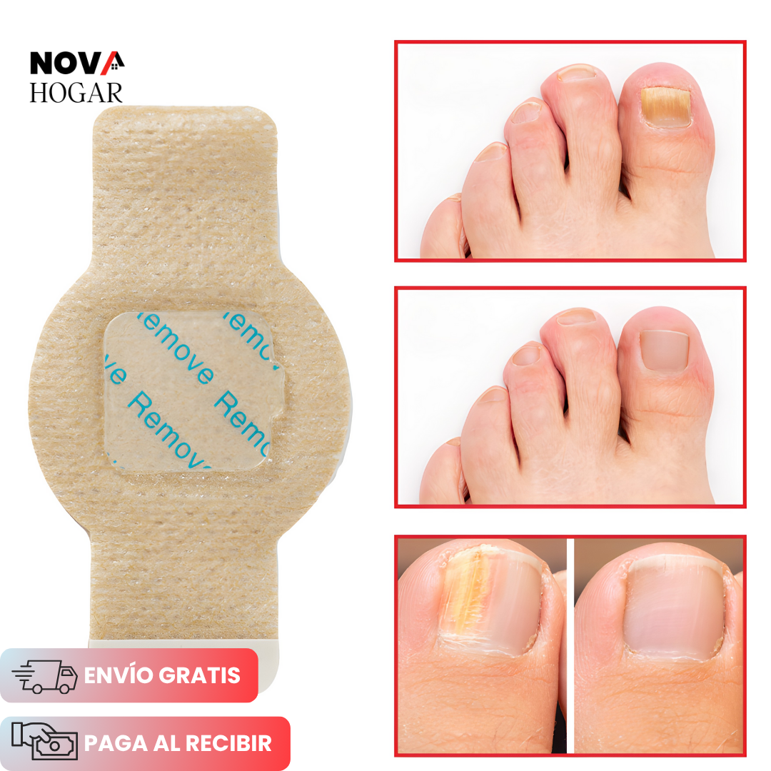 FungiClear™ Parches de Tratamiento Contra Hongos