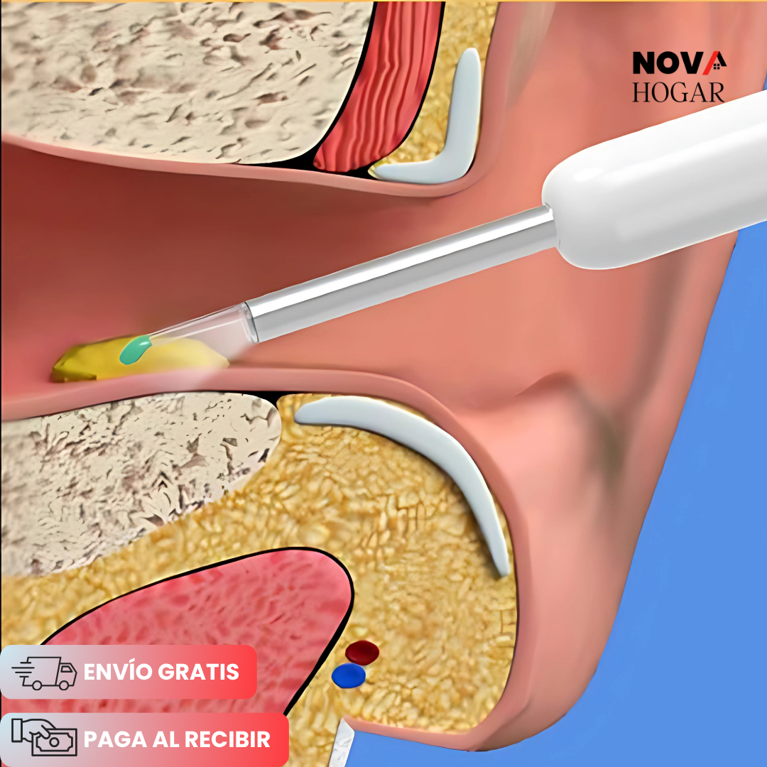 EarCare™ Nuevo Limpiador de Oidos Inteligente