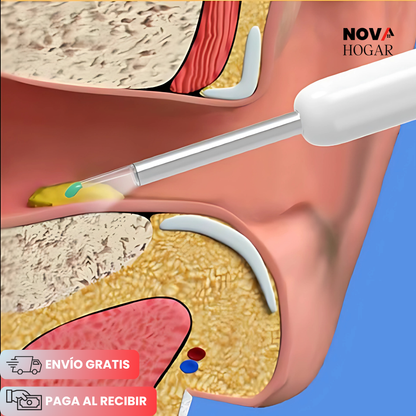 EarCare™ Nuevo Limpiador de Oidos Inteligente