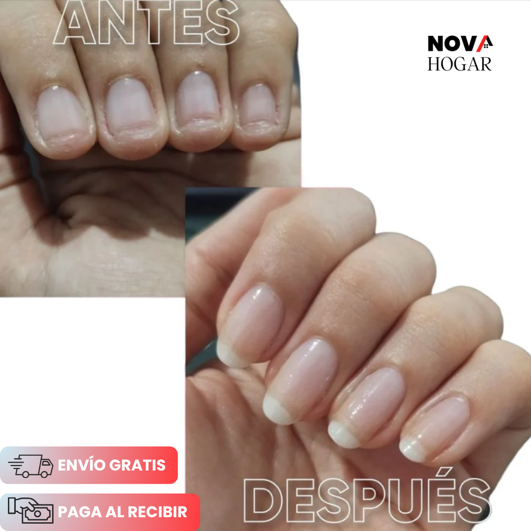 2x1 NutriUñas™ Tratamiento Fortalecedor para Uñas