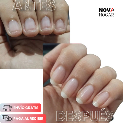 2x1 NutriUñas™ Tratamiento Fortalecedor para Uñas