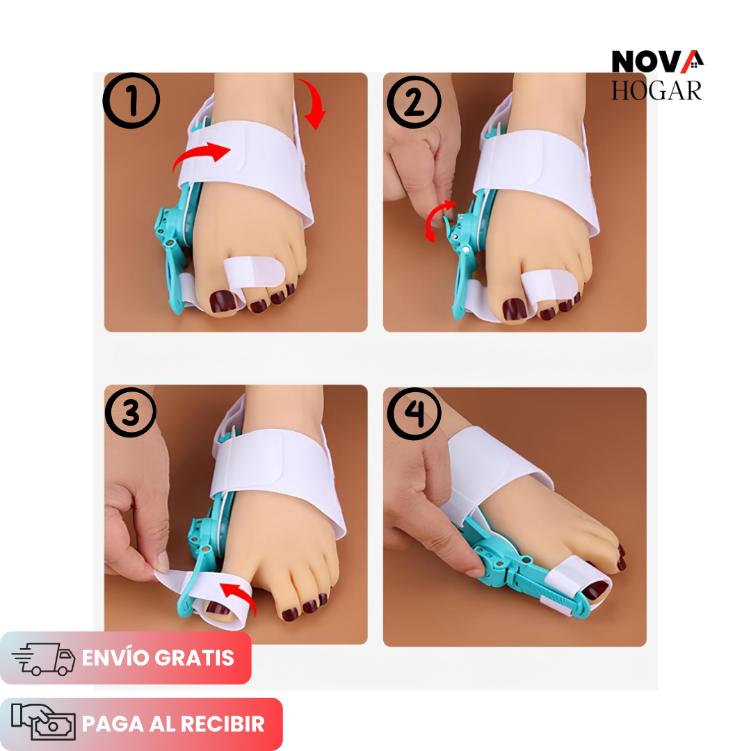 BuniFlex™ Férula Correctora de Juanetes Ajustable