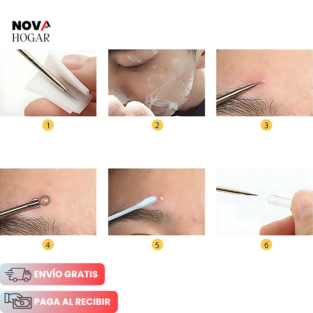 ClearPore™ Kit Dermatológico de Extracción para Acné y Granos