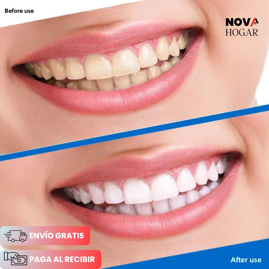 Pack x14 WhiteGlow™ Tiras Blanqueadoras de Dientes