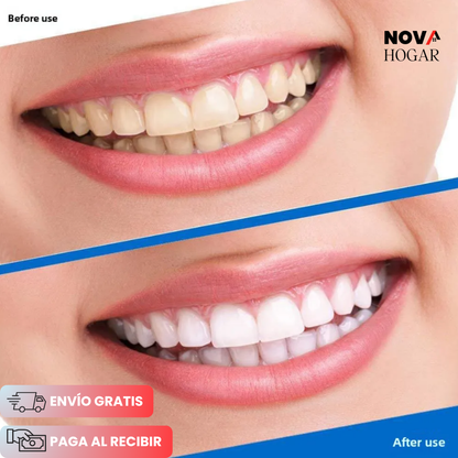 Pack x14 WhiteGlow™ Tiras Blanqueadoras de Dientes