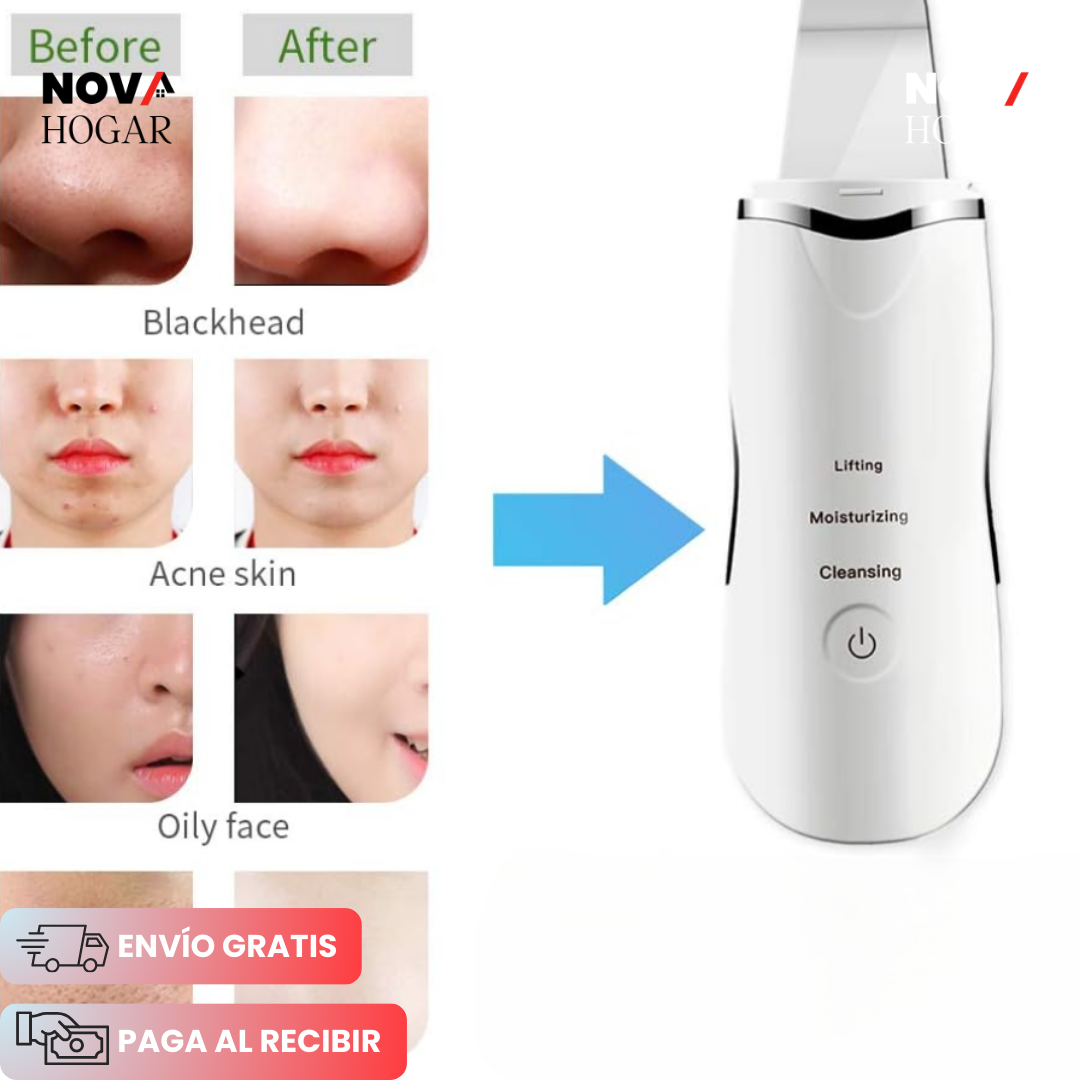 SkinLift™ Limpiador Ultrasónico + Guía para Piel Bella