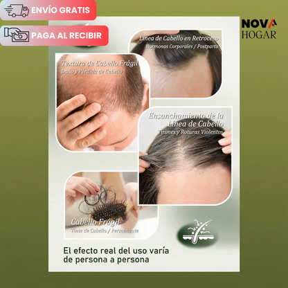 2x1 Gypsophila® Shampoo Reparador con Aceite de Batana